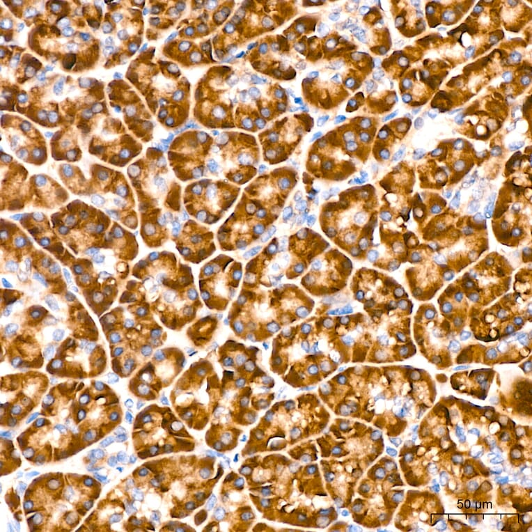 Immunohistochemistry - Anti-VHL Antibody [AMC0442] (A310017) - Antibodies.com