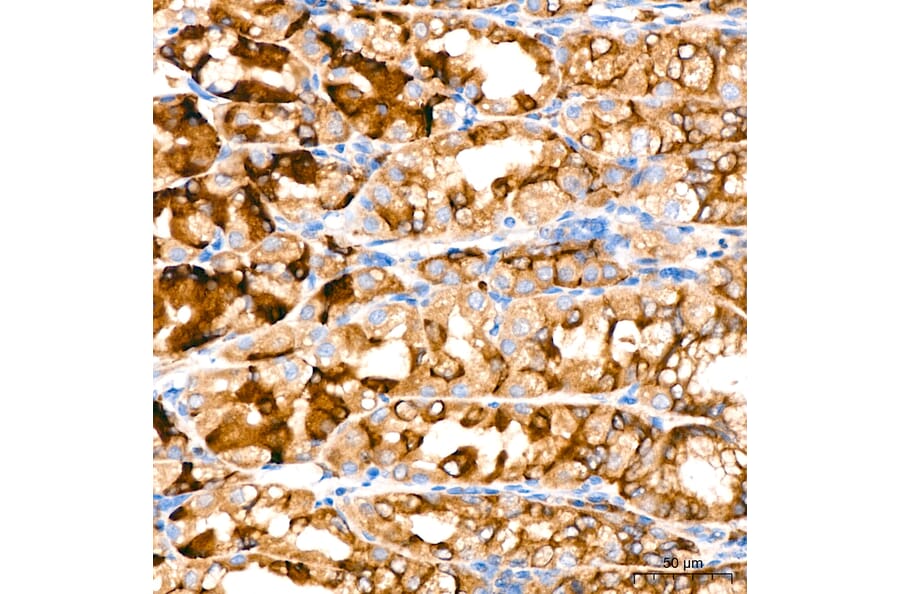 Immunohistochemistry - Anti-VHL Antibody [AMC0442] (A310017) - Antibodies.com