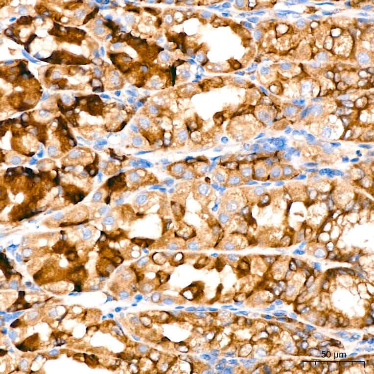 Immunohistochemistry - Anti-VHL Antibody [AMC0442] (A310017) - Antibodies.com