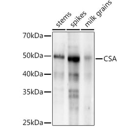 Western Blot - Anti-CSA Antibody (A310023) - Antibodies.com