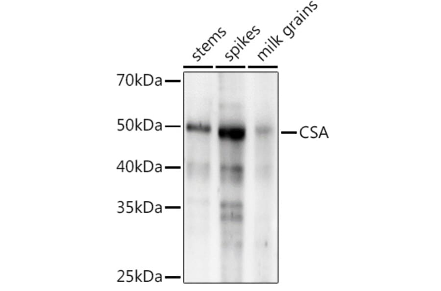 Western Blot - Anti-CSA Antibody (A310023) - Antibodies.com