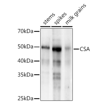 Western Blot - Anti-CSA Antibody (A310023) - Antibodies.com