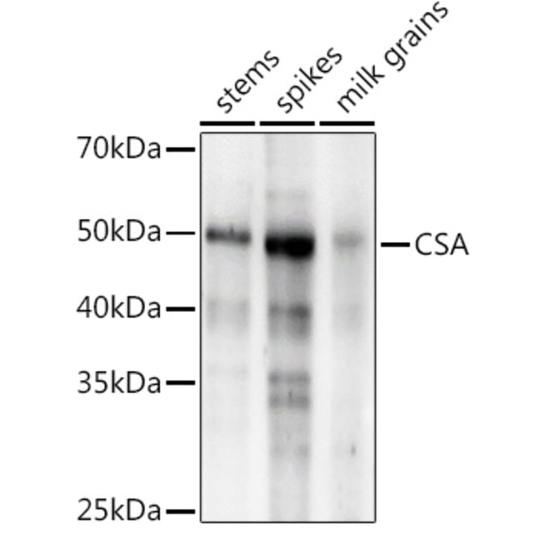 Western Blot - Anti-CSA Antibody (A310023) - Antibodies.com