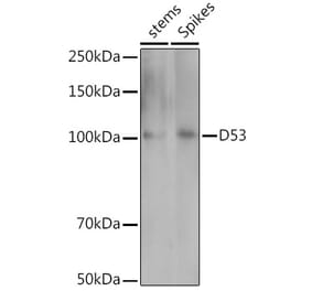 Western Blot - Anti-D53 Antibody (A310026) - Antibodies.com