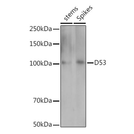 Western Blot - Anti-D53 Antibody (A310026) - Antibodies.com