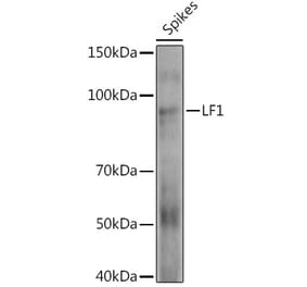 Western Blot - Anti-HOX10 Antibody (A310033) - Antibodies.com