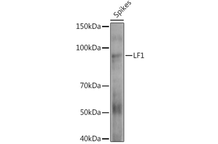 Western Blot - Anti-HOX10 Antibody (A310033) - Antibodies.com