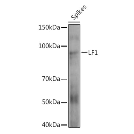 Western Blot - Anti-HOX10 Antibody (A310033) - Antibodies.com