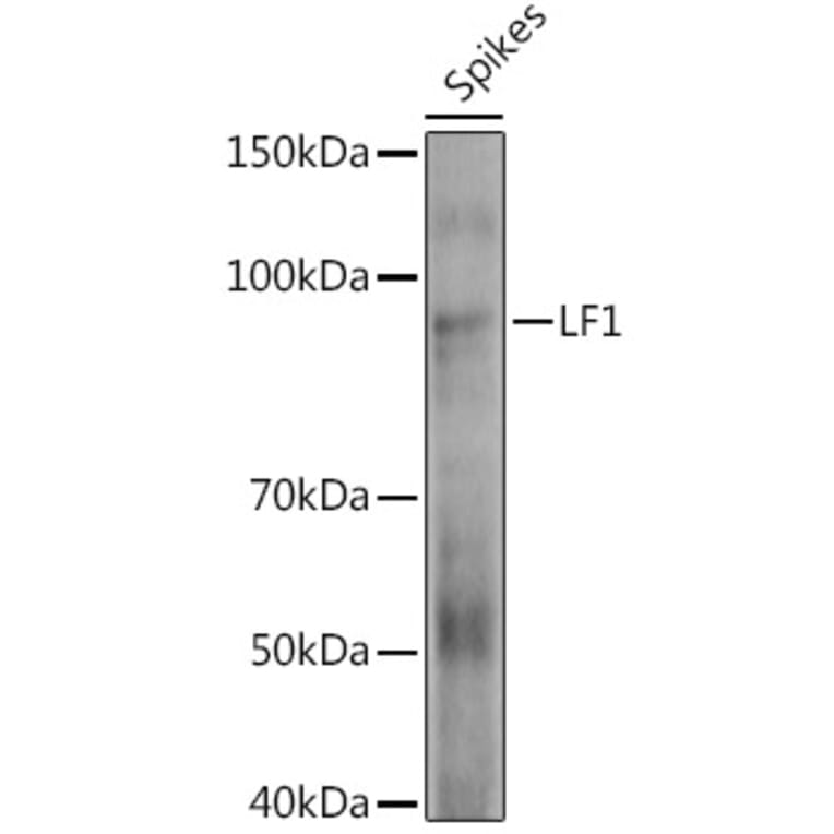 Western Blot - Anti-HOX10 Antibody (A310033) - Antibodies.com