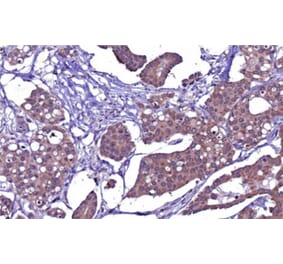Immunohistochemistry - Anti-PAX3 Antibody [PAX3/8426] - BSA and Azide free (A316851) - Antibodies.com