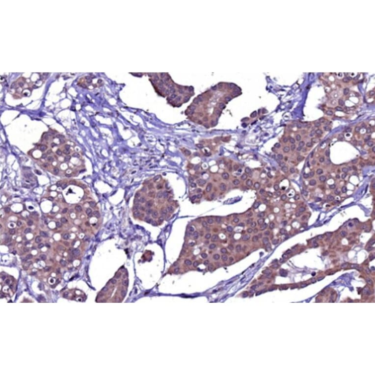 Immunohistochemistry - Anti-PAX3 Antibody [PAX3/8426] - BSA and Azide free (A316851) - Antibodies.com