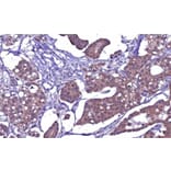 Immunohistochemistry - Anti-PAX3 Antibody [PAX3/8426] - BSA and Azide free (A316851) - Antibodies.com