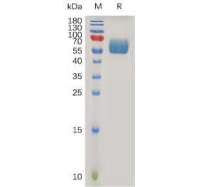 SDS-PAGE - Recombinant Human TGF beta Receptor II Protein (Fc Tag) (A317217) - Antibodies.com