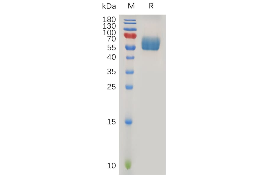 SDS-PAGE - Recombinant Human TGF beta Receptor II Protein (Fc Tag) (A317217) - Antibodies.com