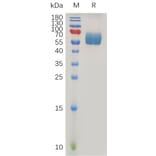 SDS-PAGE - Recombinant Human TGF beta Receptor II Protein (Fc Tag) (A317217) - Antibodies.com