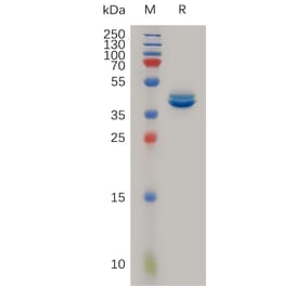 SDS-PAGE - Recombinant Human MCP1 Protein (Fc Tag) (A317238) - Antibodies.com