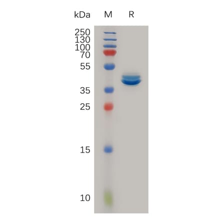 SDS-PAGE - Recombinant Human MCP1 Protein (Fc Tag) (A317238) - Antibodies.com