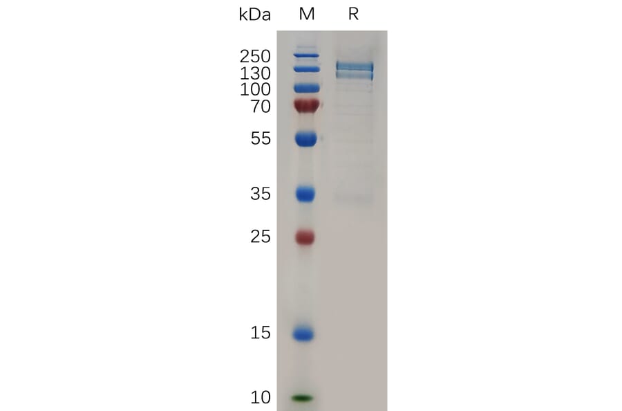 SDS-PAGE - Recombinant Human RON Protein (Fc Tag) (A317261) - Antibodies.com