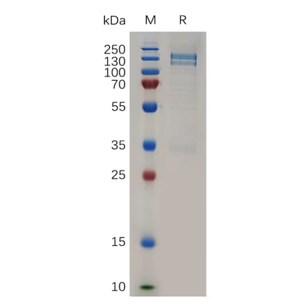 SDS-PAGE - Recombinant Human RON Protein (Fc Tag) (A317261) - Antibodies.com