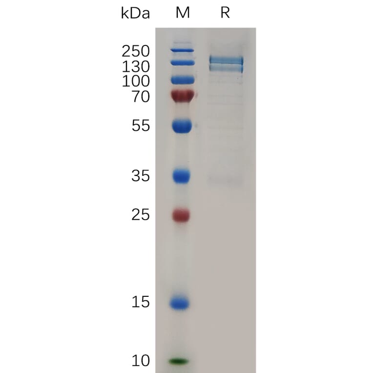 SDS-PAGE - Recombinant Human RON Protein (Fc Tag) (A317261) - Antibodies.com