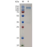 SDS-PAGE - Recombinant Human RON Protein (Fc Tag) (A317261) - Antibodies.com