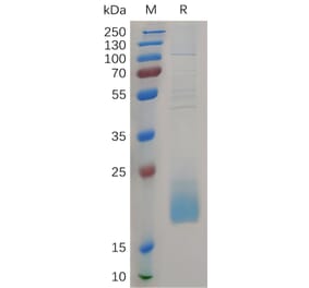 SDS-PAGE - Recombinant Human CD3d Protein (6×His Tag) (A317266) - Antibodies.com