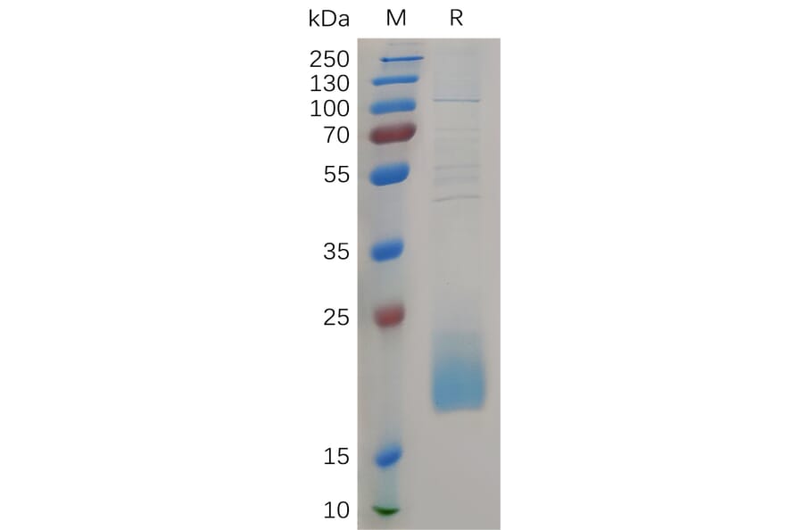 SDS-PAGE - Recombinant Human CD3d Protein (6×His Tag) (A317266) - Antibodies.com