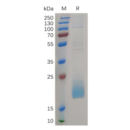 SDS-PAGE - Recombinant Human CD3d Protein (6×His Tag) (A317266) - Antibodies.com