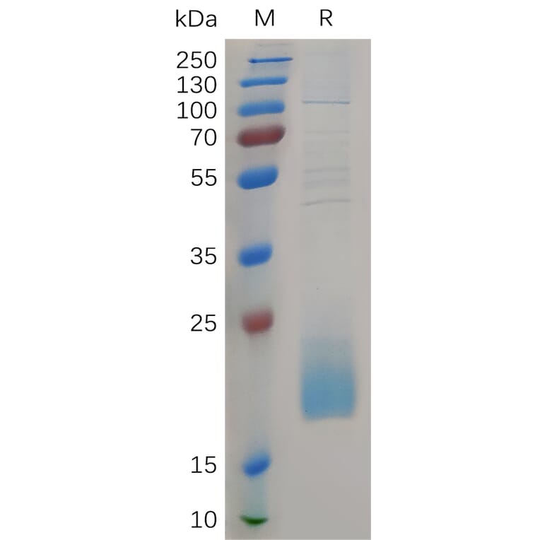 SDS-PAGE - Recombinant Human CD3d Protein (6×His Tag) (A317266) - Antibodies.com