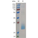 SDS-PAGE - Recombinant Human CD3d Protein (6×His Tag) (A317266) - Antibodies.com