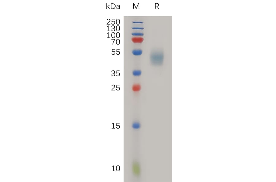 SDS-PAGE - Recombinant Human uPA Receptor/U-PAR Protein (6×His Tag) (A317267) - Antibodies.com