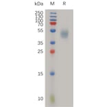 SDS-PAGE - Recombinant Human uPA Receptor/U-PAR Protein (6×His Tag) (A317267) - Antibodies.com