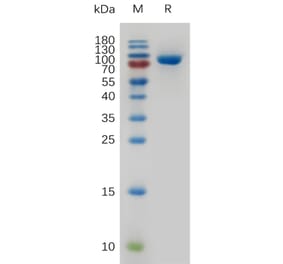 SDS-PAGE - Recombinant Human Transferrin Receptor Protein (6×His Tag) (A317269) - Antibodies.com