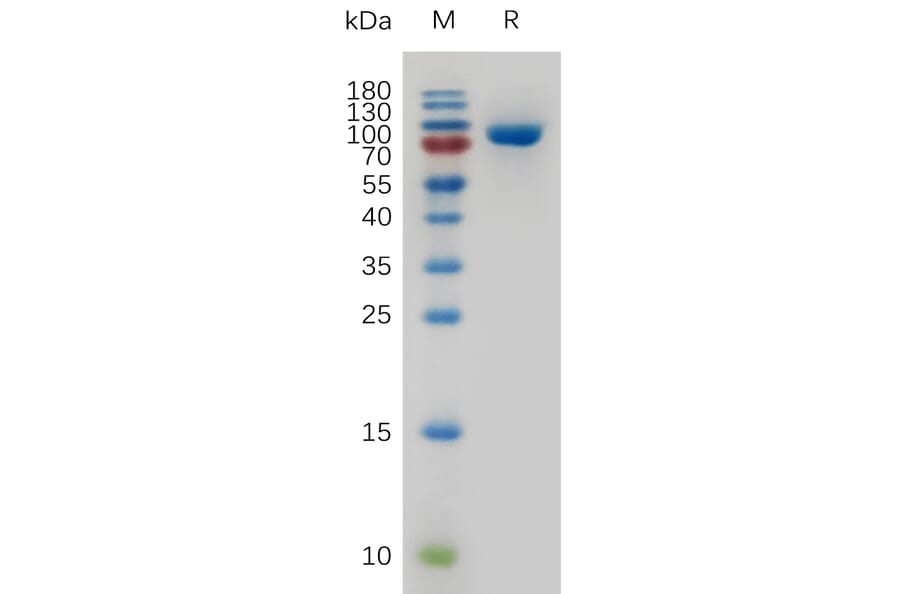 SDS-PAGE - Recombinant Human Transferrin Receptor Protein (6×His Tag) (A317269) - Antibodies.com