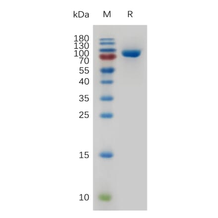 SDS-PAGE - Recombinant Human Transferrin Receptor Protein (6×His Tag) (A317269) - Antibodies.com