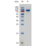 SDS-PAGE - Recombinant Human Transferrin Receptor Protein (6×His Tag) (A317269) - Antibodies.com