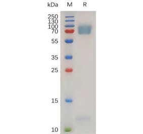 SDS-PAGE - Recombinant Human EMR2 Protein (7×His Tag) (A317272) - Antibodies.com