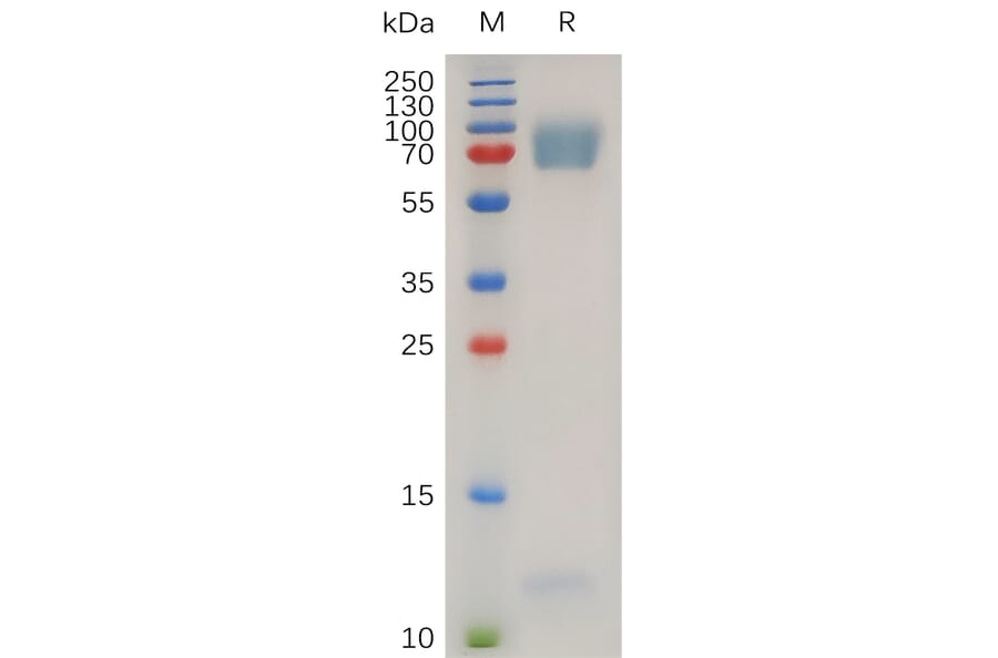 SDS-PAGE - Recombinant Human EMR2 Protein (7×His Tag) (A317272) - Antibodies.com