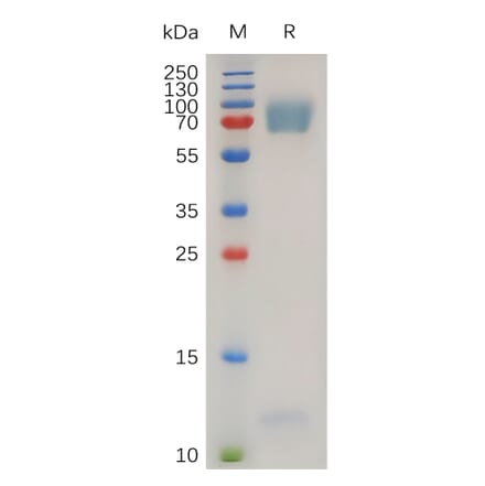 SDS-PAGE - Recombinant Human EMR2 Protein (7×His Tag) (A317272) - Antibodies.com