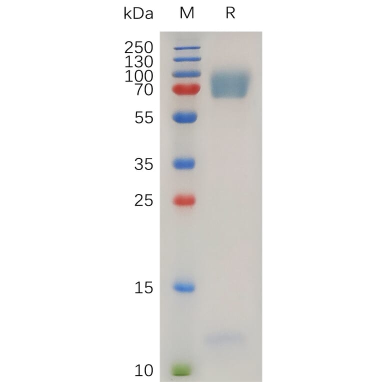 SDS-PAGE - Recombinant Human EMR2 Protein (7×His Tag) (A317272) - Antibodies.com