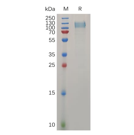 SDS-PAGE - Recombinant Human Ret Protein (6×His Tag) (A317274) - Antibodies.com