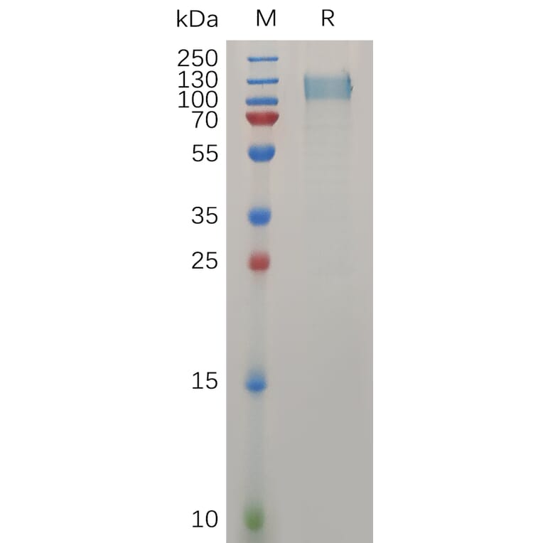 SDS-PAGE - Recombinant Human Ret Protein (6×His Tag) (A317274) - Antibodies.com