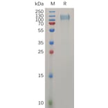 SDS-PAGE - Recombinant Human Ret Protein (6×His Tag) (A317274) - Antibodies.com
