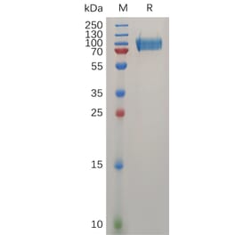 SDS-PAGE - Recombinant Human CD146 Protein (6×His Tag) (A317275) - Antibodies.com