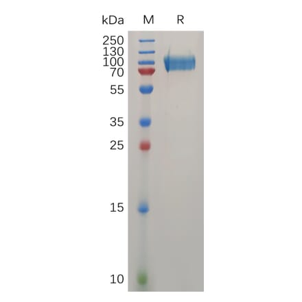 SDS-PAGE - Recombinant Human CD146 Protein (6×His Tag) (A317275) - Antibodies.com