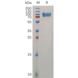 SDS-PAGE - Recombinant Human CD146 Protein (6×His Tag) (A317275) - Antibodies.com
