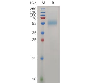 SDS-PAGE - Recombinant Human ZP3 Protein (6×His Tag) (A317276) - Antibodies.com