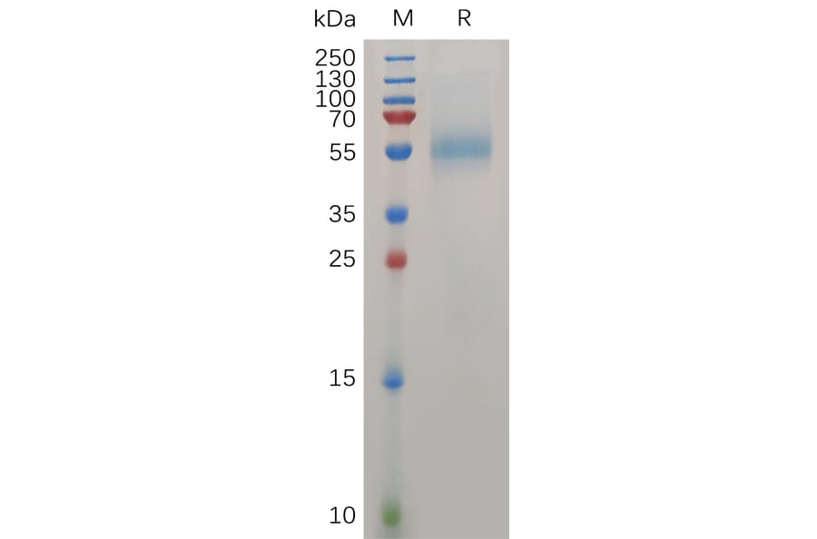 SDS-PAGE - Recombinant Human ZP3 Protein (6×His Tag) (A317276) - Antibodies.com