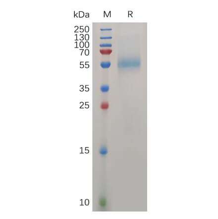 SDS-PAGE - Recombinant Human ZP3 Protein (6×His Tag) (A317276) - Antibodies.com