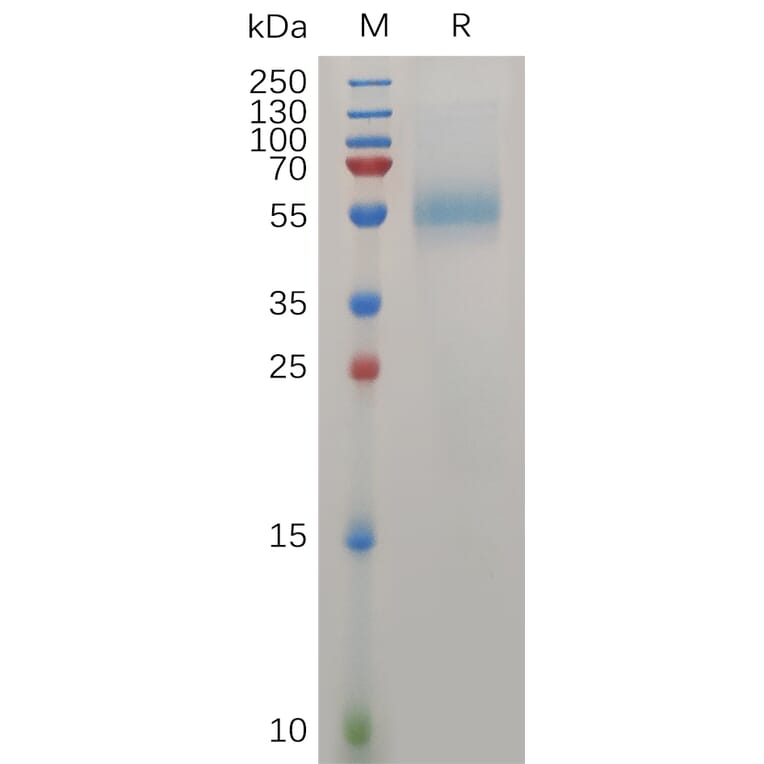 SDS-PAGE - Recombinant Human ZP3 Protein (6×His Tag) (A317276) - Antibodies.com